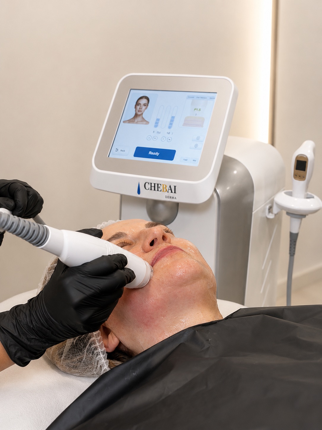 Equipo UltraLift en una cabina de estética