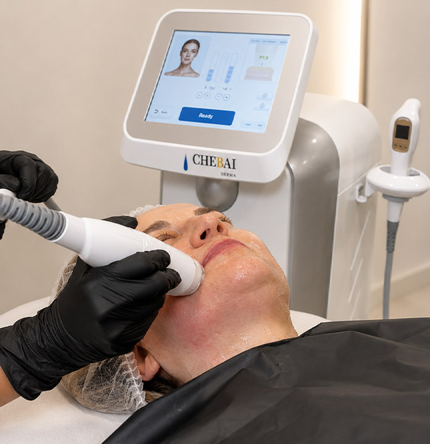 Ultralift tratamiento con exosomas